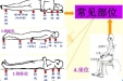 脊髓损伤患者如何预防压疮