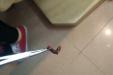 惊讶！一女子用泉水洗脸后从鼻子夹出这样的虫子
