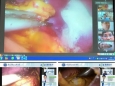 我院开展手术线上直播 共话胃肠肿瘤微创技术