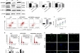 我院皮肤科杨猛博士在J CELL MOL MED期刊发表影响因子为5.310的论文