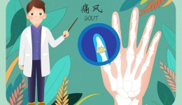 让“痛”随“风”去！4月20日，这场痛风义诊等你来