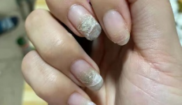 为什么爱美的女生在卸甲后，发现指甲内部会变绿呢？