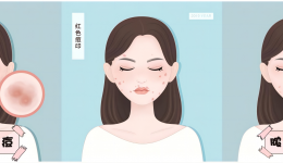长痘痘能不能做超光子？