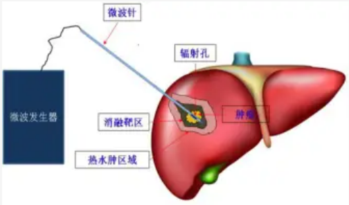 图片 3