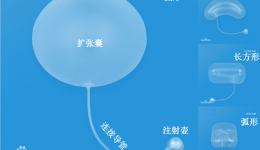 皮肤软组织扩张器科普