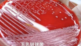 产妇生产前为什么要检测B族链球菌?