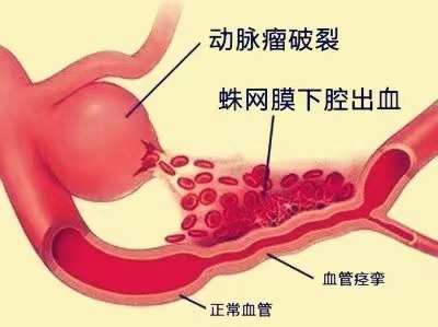 图片 3